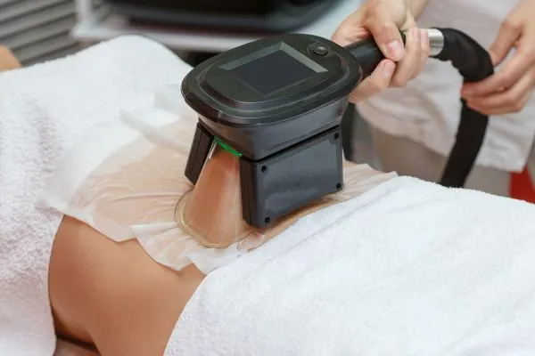 Image of person having fat freezing treatment to help weight gain Swansea