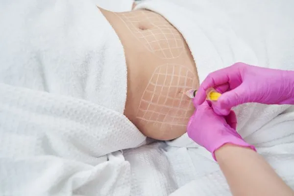 image of fat dissolving injections on love handles to help combat weight gain Swansea