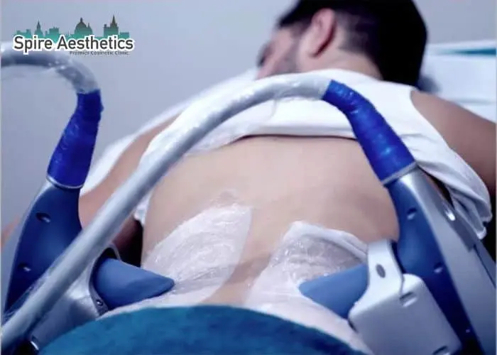 Man having fat freezing treatment done on love handles before a competitions Swansea to create a sculpted look.