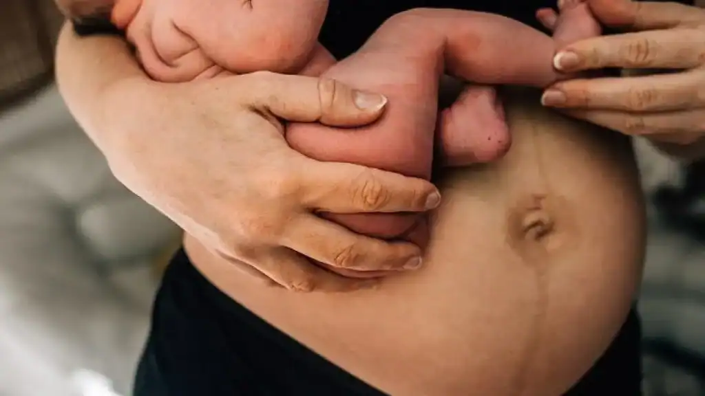 Why Is My Stomach Still Big After Pregnancy Swansea?